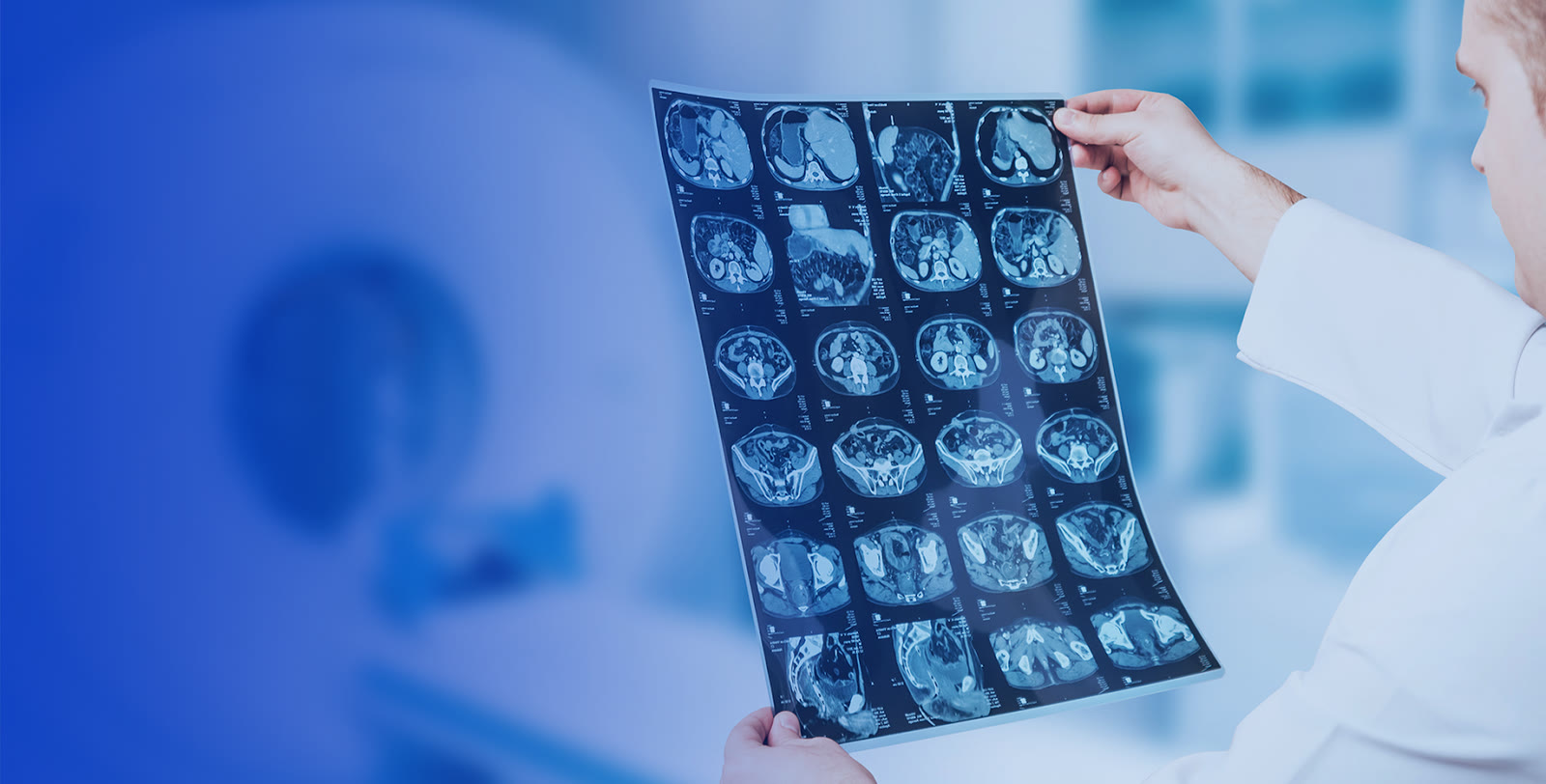 A radiologist holding up MRI scan films for review