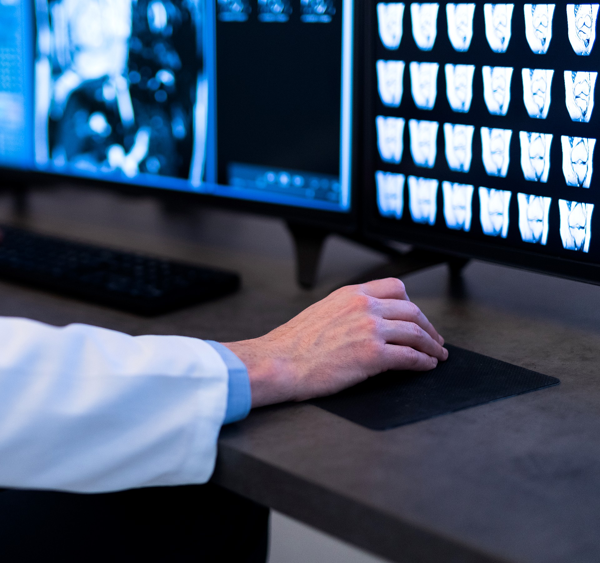 A radiologist reviewing MRI and CT scan results at a workstation