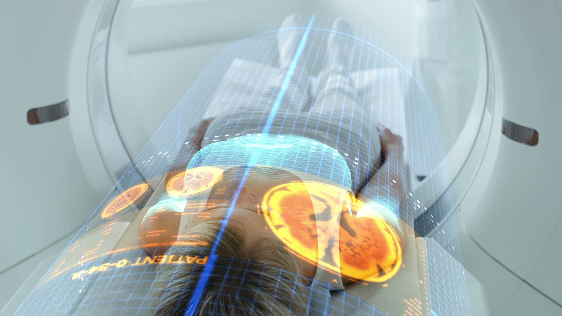 A patient undergoing an MRI scan with a diagnostic imaging visualization overlay