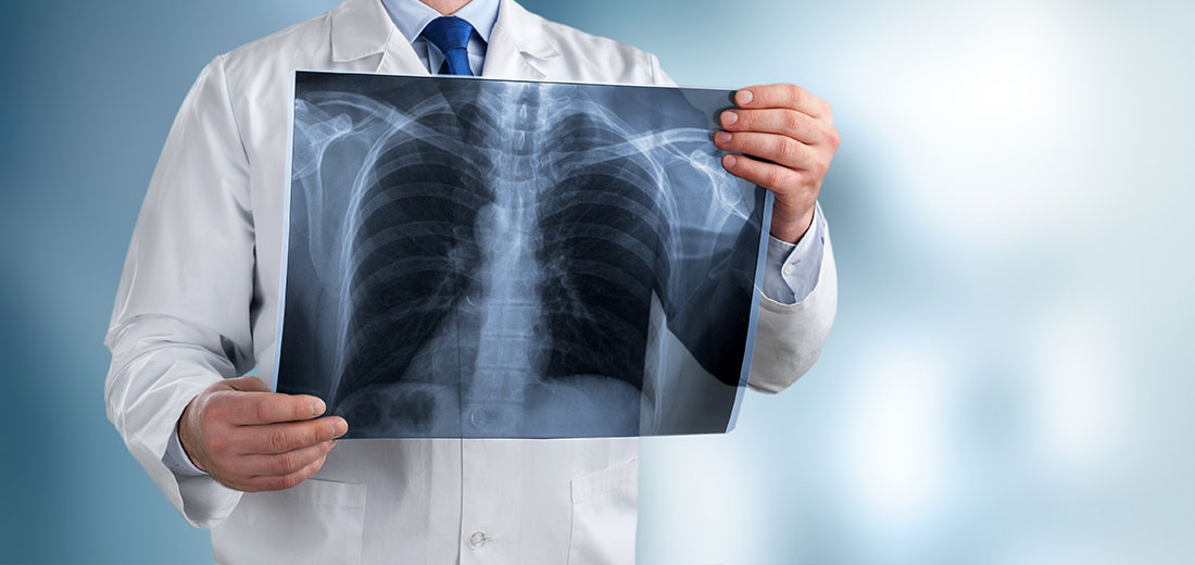 Diagnostic Imaging After An Accident or Injury Florida MRI MDN